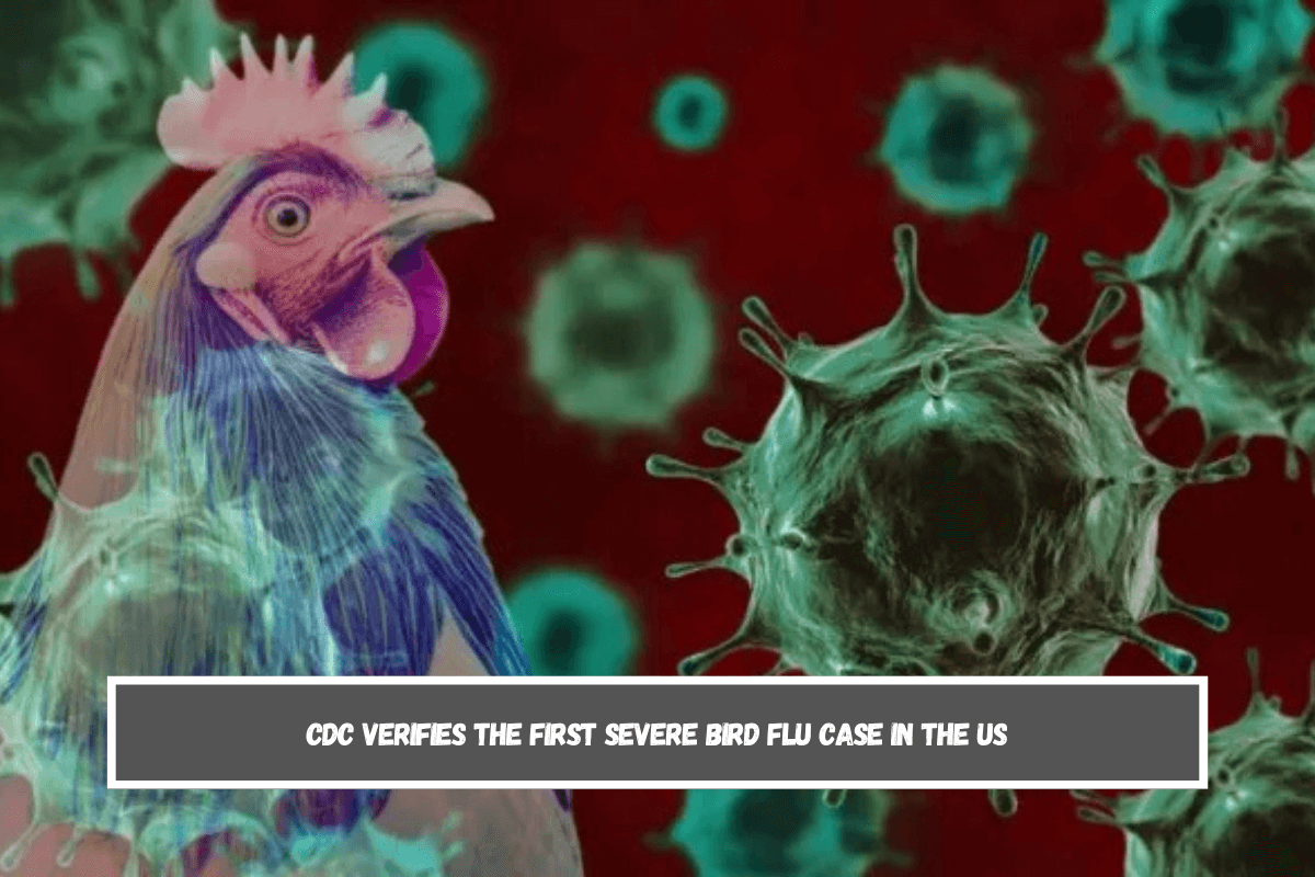 CDC verifies the first severe bird flu case in the US The Transfer