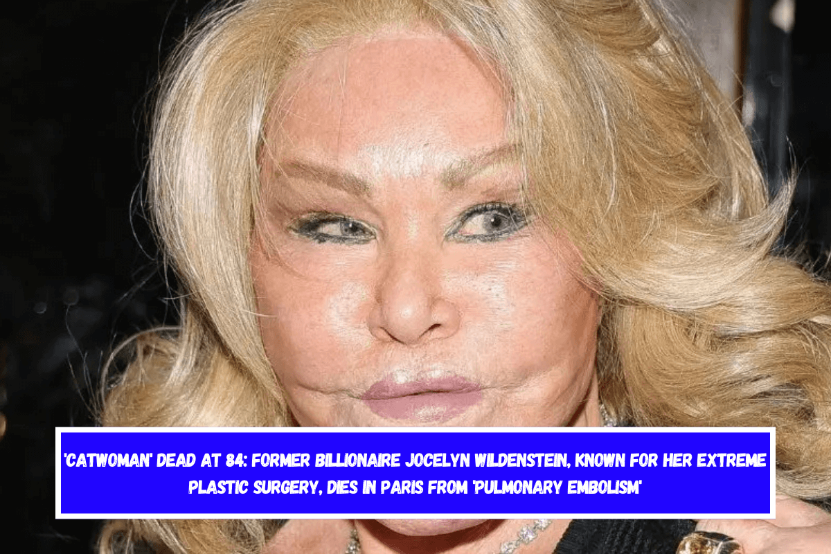 'Catwoman' Dead At 84 Former Billionaire Jocelyn Wildenstein, Known For Her Extreme Plastic Surgery, Dies In Paris From 'Pulmonary Embolism'